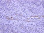 BEGAIN Polyclonal Antibody