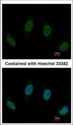 TTC40 Polyclonal Antibody