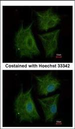 AGBL4 Polyclonal Antibody