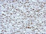 THAP11 Polyclonal Antibody