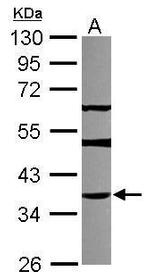 THAP11 Antibody in Western Blot (WB)