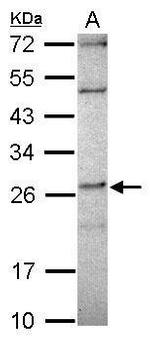 DPCD Polyclonal Antibody