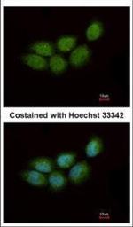 ZCCHC4 Polyclonal Antibody