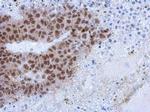 ZCCHC4 Antibody in Immunohistochemistry (Paraffin) (IHC (P))