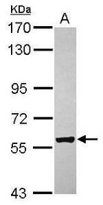 ZCCHC4 Antibody in Western Blot (WB)
