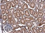 CHCHD3 Antibody in Immunohistochemistry (Paraffin) (IHC (P))