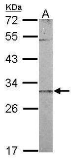 CHCHD3 Antibody in Western Blot (WB)
