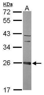 CCDC90B Antibody in Western Blot (WB)