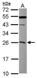 CCDC90B Antibody in Western Blot (WB)