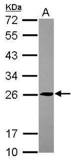 TMED5 Polyclonal Antibody