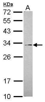 GALNT12 Polyclonal Antibody