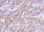 CTTNBP2NL Polyclonal Antibody