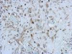 ANKS3 Antibody in Immunohistochemistry (Paraffin) (IHC (P))