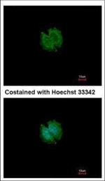 CATSPERB Polyclonal Antibody