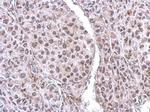 CUTC Antibody in Immunohistochemistry (Paraffin) (IHC (P))