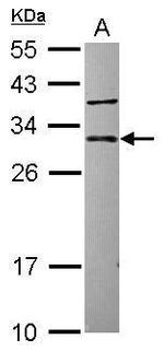 CUTC Antibody in Western Blot (WB)
