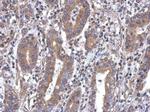 MTG1 Polyclonal Antibody