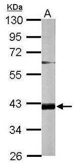 FAM46D Antibody in Western Blot (WB)