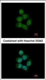 ARS2 Polyclonal Antibody