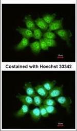 THOC7 Antibody in Immunocytochemistry (ICC/IF)