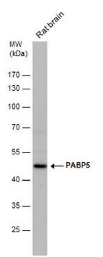 PABPC5 Antibody in Western Blot (WB)