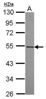 RASGEF1A Polyclonal Antibody