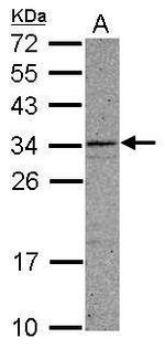 CCDC107 Polyclonal Antibody
