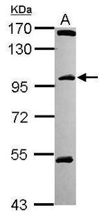 C18orf34 Antibody in Western Blot (WB)