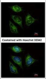 ABCF3 Polyclonal Antibody
