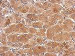 SLC25A36 Polyclonal Antibody