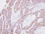 EAP30 Polyclonal Antibody