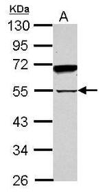 SPAG8 Antibody in Western Blot (WB)