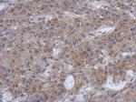 PPFIBP1 Polyclonal Antibody