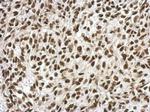 RPRD1B Antibody in Immunohistochemistry (Paraffin) (IHC (P))