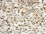 RPRD1B Antibody in Immunohistochemistry (Paraffin) (IHC (P))