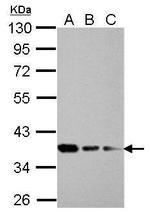 RPRD1B Antibody in Western Blot (WB)