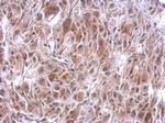 SLFNL1 Polyclonal Antibody