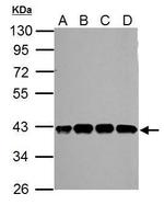 SLFNL1 Antibody in Western Blot (WB)