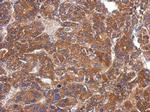 ARHGAP36 Polyclonal Antibody