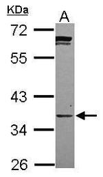 PPCS Polyclonal Antibody