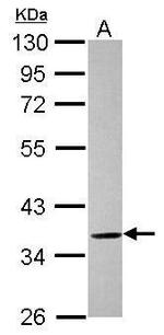 ELMOD1 Polyclonal Antibody