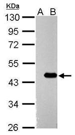 ZBTB24 Polyclonal Antibody