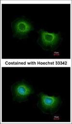 ST3GAL3 Polyclonal Antibody