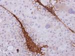 ST3GAL3 Antibody in Immunohistochemistry (Paraffin) (IHC (P))