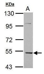 KLHDC5 Antibody in Western Blot (WB)