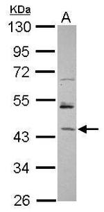 RBM17 Polyclonal Antibody