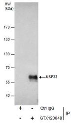 USP22 Antibody in Immunoprecipitation (IP)