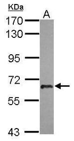 USP22 Antibody in Western Blot (WB)