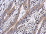 FBXW5 Polyclonal Antibody