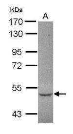 CCDC17 Antibody in Western Blot (WB)